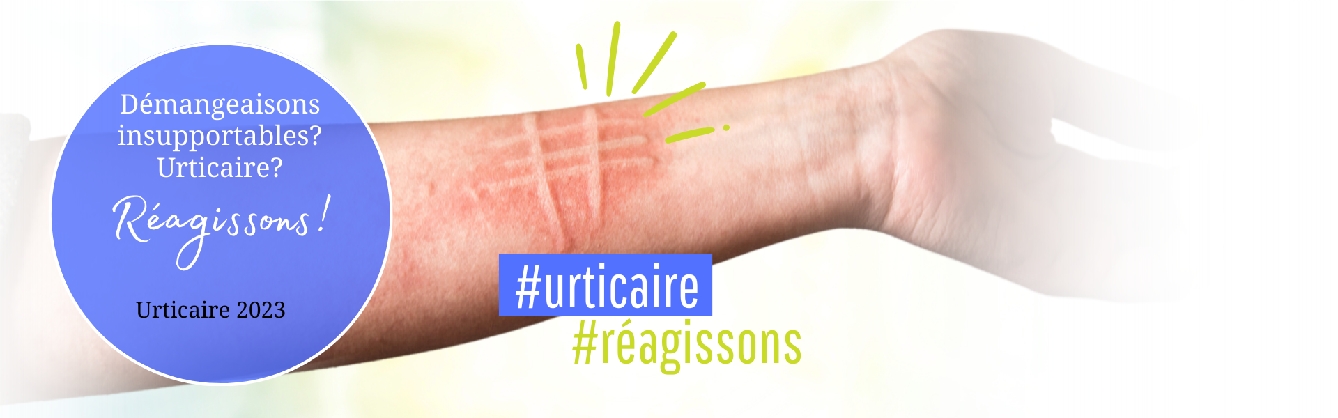 aha! Centre d'Allergie Suisse 2023 Urtikaria