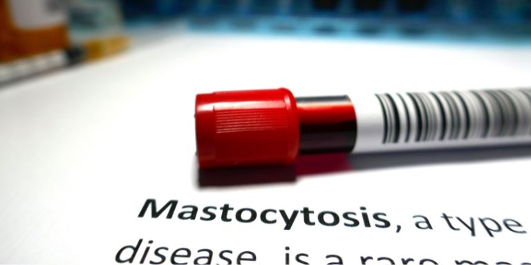 Blutröhrchen auf einem Dokument zum Thema Mastozytose.