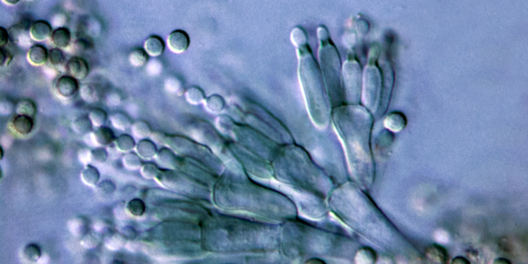 Image de la moisissure au microscope