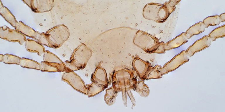 Hausstaubmilbe unter dem Mikroskop