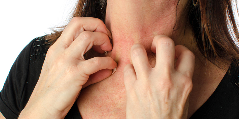 La donna si gratta forte il collo arrossato con entrambe le mani.
