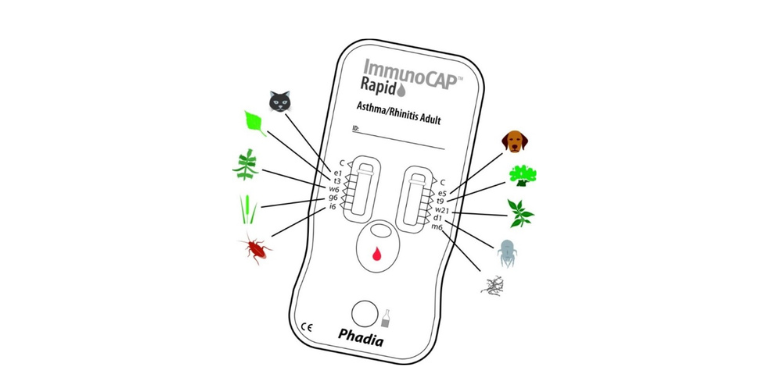 ImmunoCAP Rapid